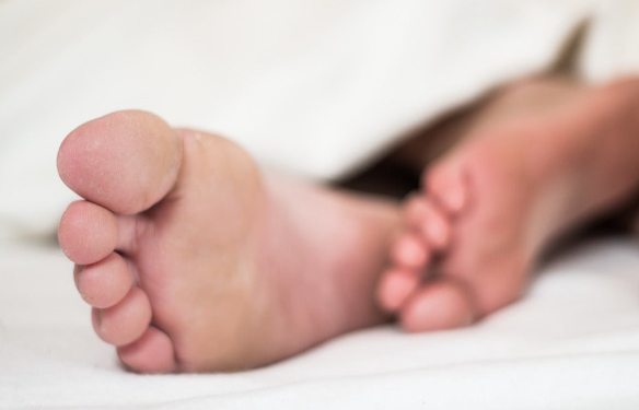 Feet of a person with CMT